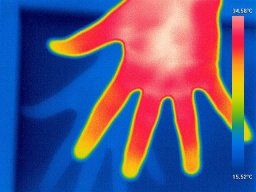 Hand